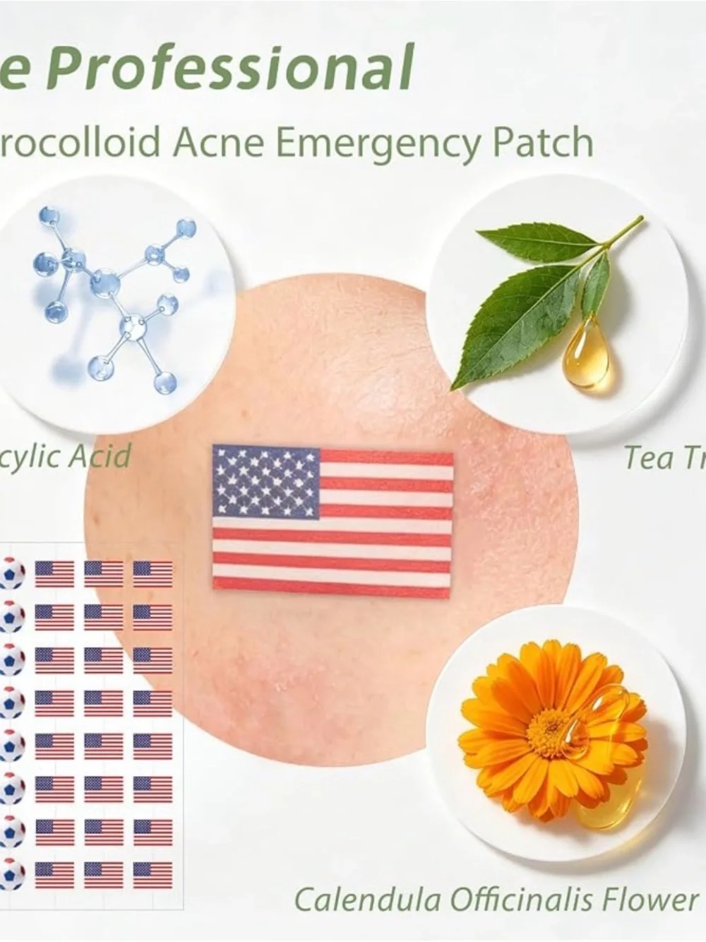 Anchiray hydrocolloid pimple